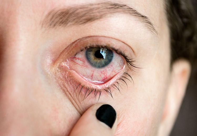 Doenças oculares: conheça os dez transtornos mais comuns